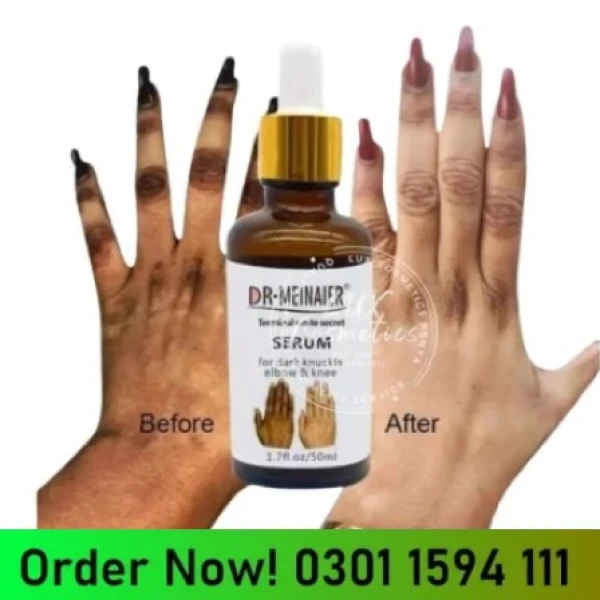 Dr-Meinaier Serum In Pakistan